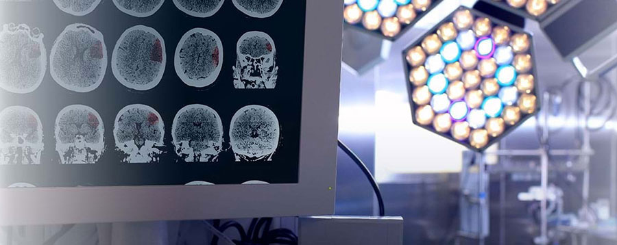 Rockefeller Neurosciences Institute clinical image.