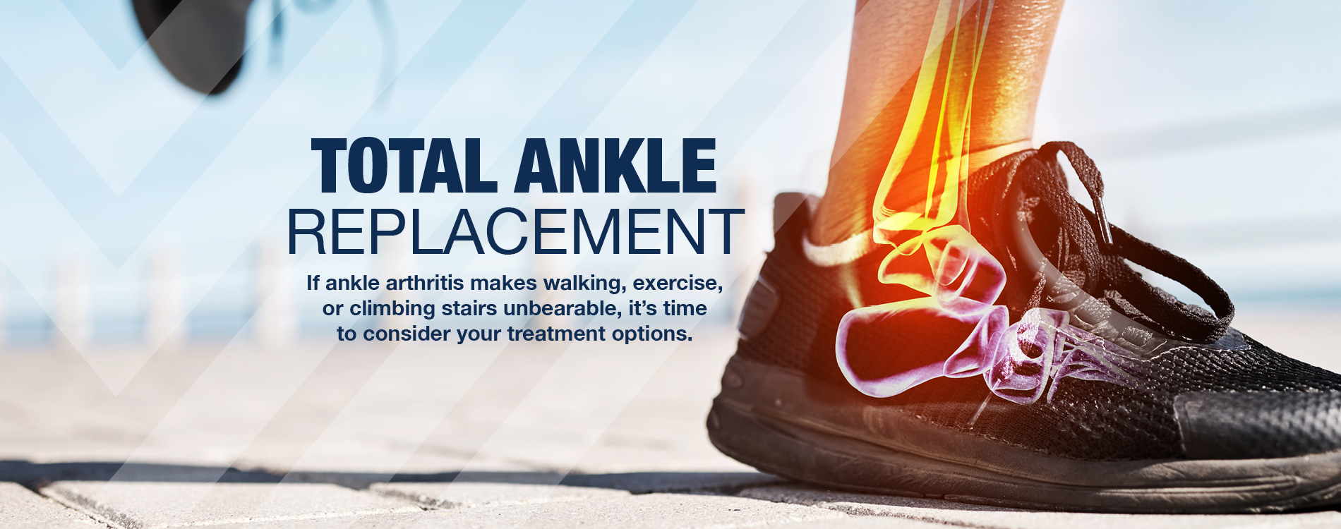 Total Ankle Replacement If ankle arthritis make walking, exercise, or climbing stairs unbearable, it