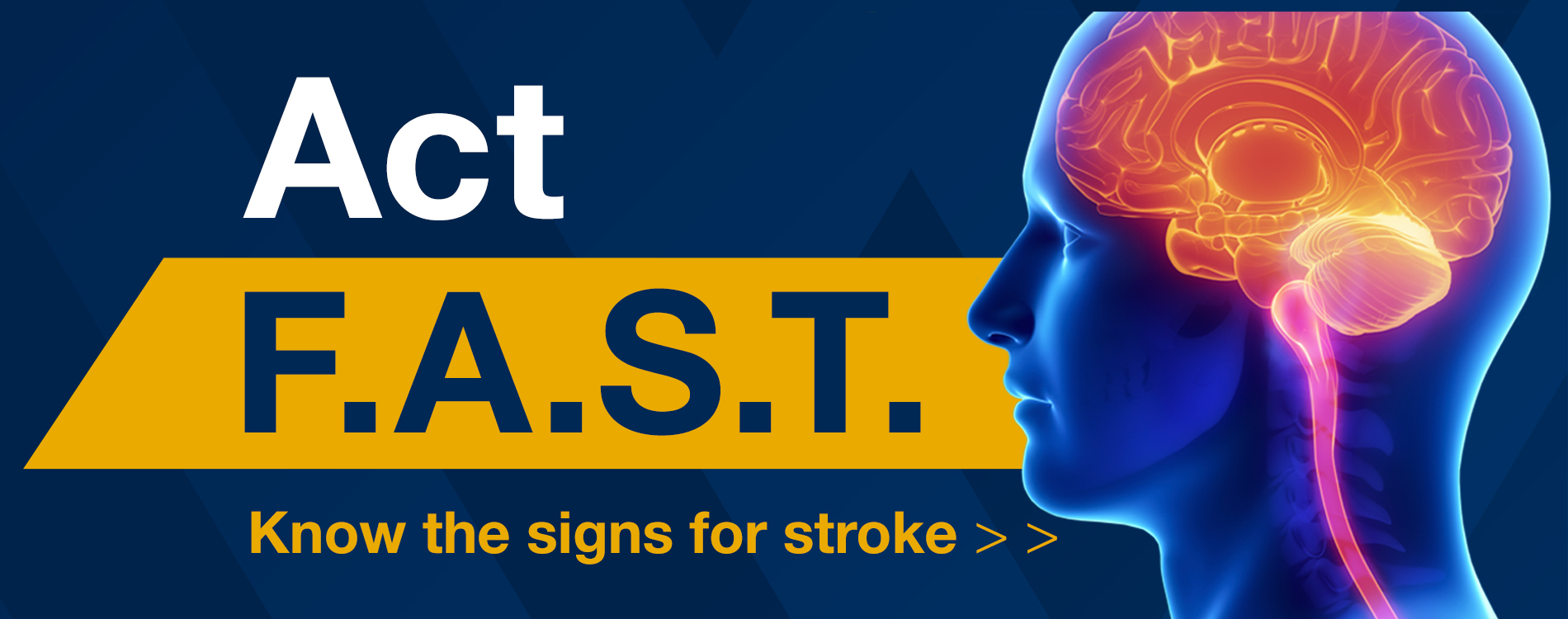 Act F.A.S.T. Know the signs of stroke header image