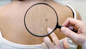 Dermatology-300x169 | WVU Medicine