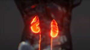 Nephrology-300x169 | WVU Medicine